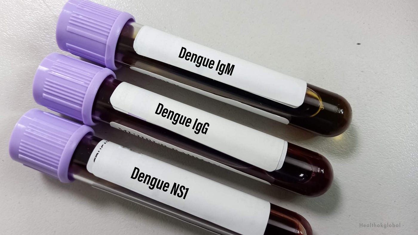 NS1 Antigen Test: Early Detection of Dengue Fever