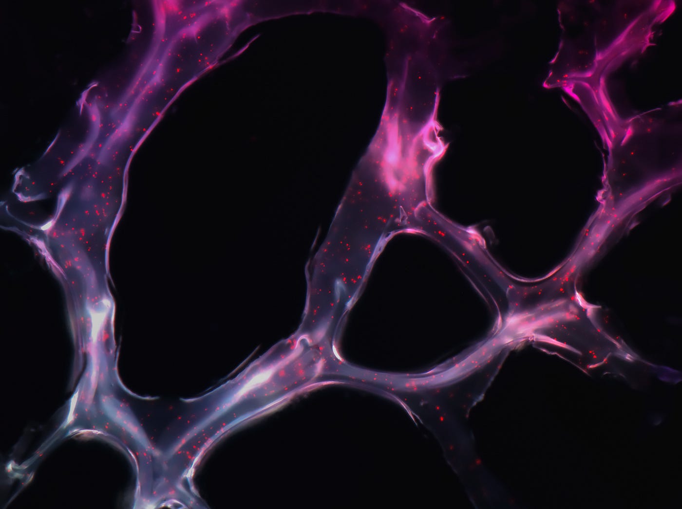 Carcinoembryonic Antigen-Related Cell Adhesion Molecules (CEACAMs)