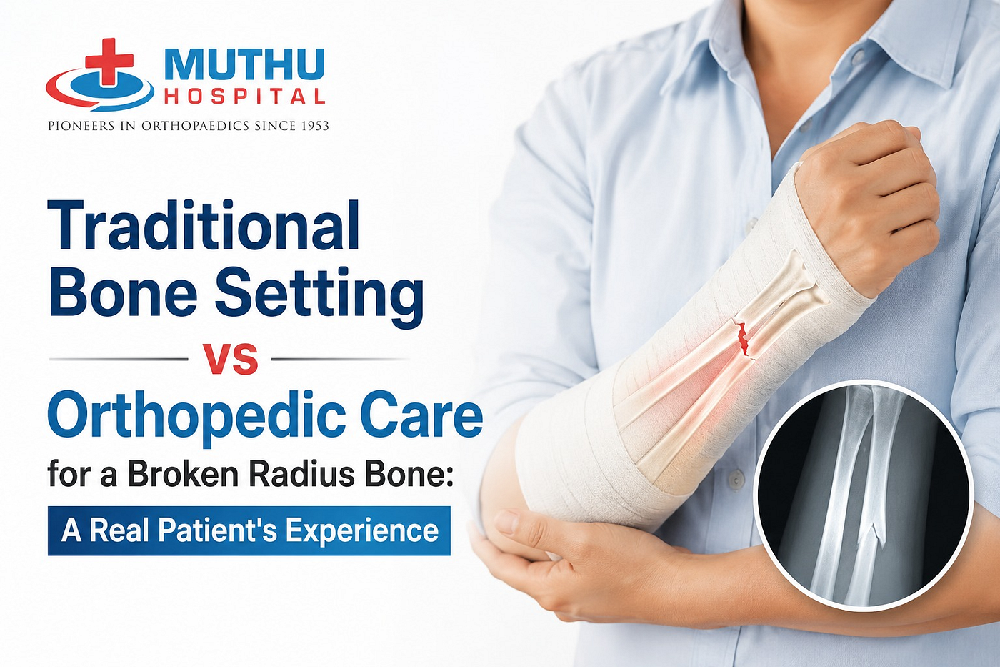 Traditional Bone Setting vs Orthopedic Care for a Broken Radius Bone: A Real Patient’s Experience