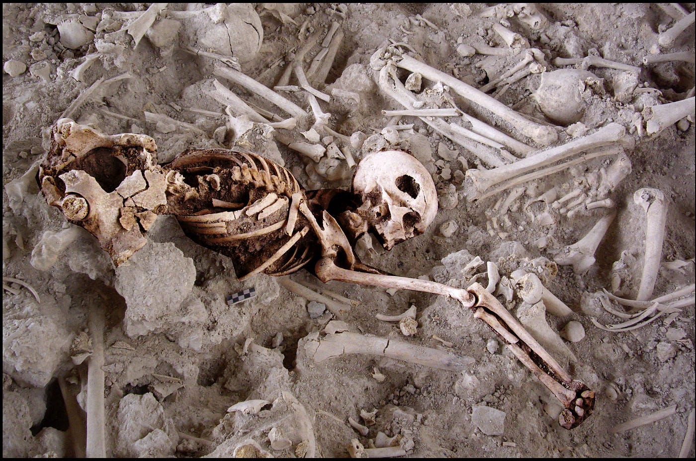 The Children Who Couldn’t Breathe: Tuberculosis May Have Ravaged Children 5,000 Years Ago