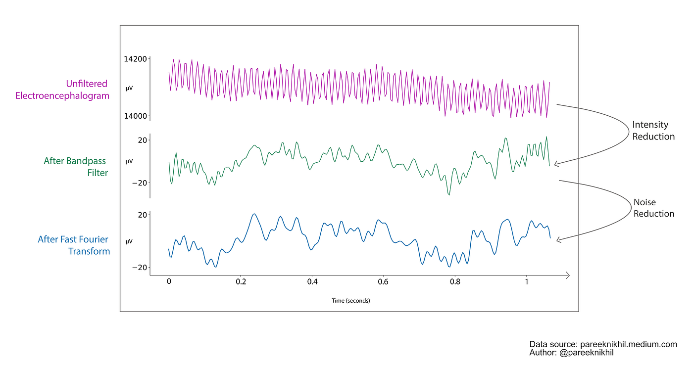 EEG 101 using OpenBCI Ultracortex | by Nikhil Pareek | Towards Data Science