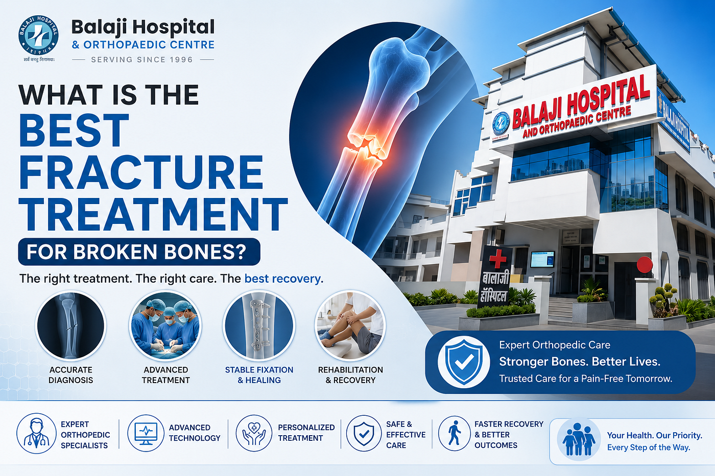 What Is the Best Fracture Treatment for Broken Bones