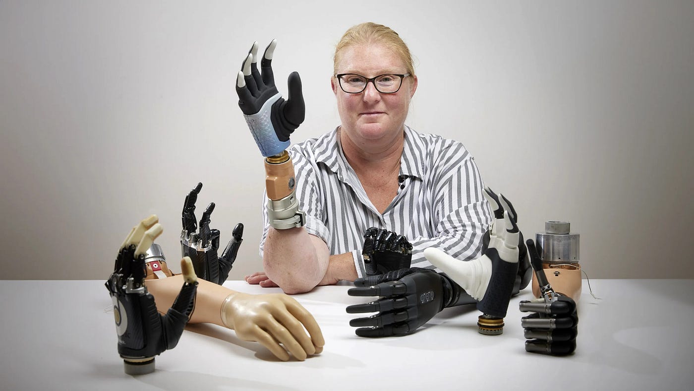 The Future of Bionic Prosthetic Hands in Malaysia