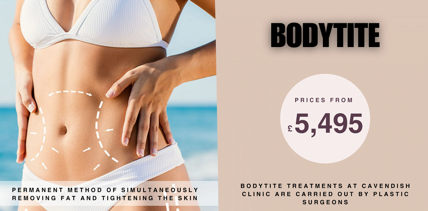 BodyTite: The Ultimate Guide to Radiofrequency Body Sculpting, by  Cavendish Clinic