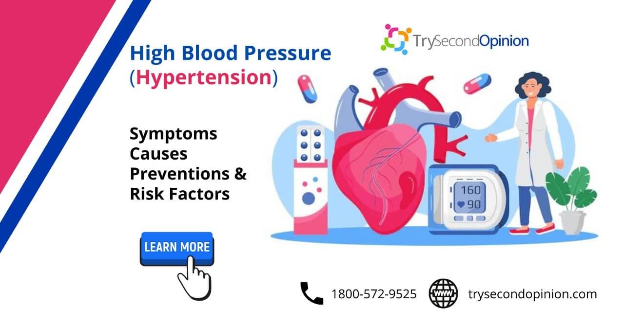High blood pressure: What is high, symptoms, causes, and more