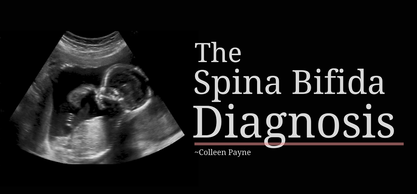 Spina Bifida - A Neural Tube Defect - MEDizzy
