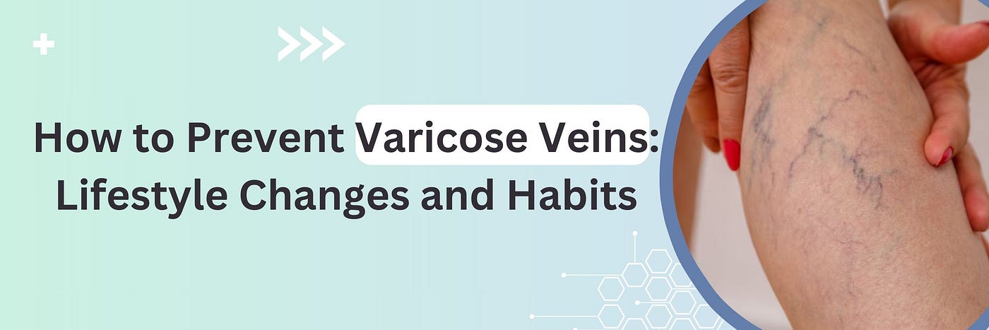 How to Prevent Varicose Veins: Lifestyle Changes and Habits, by  Madhuvanthis, Jan, 2024