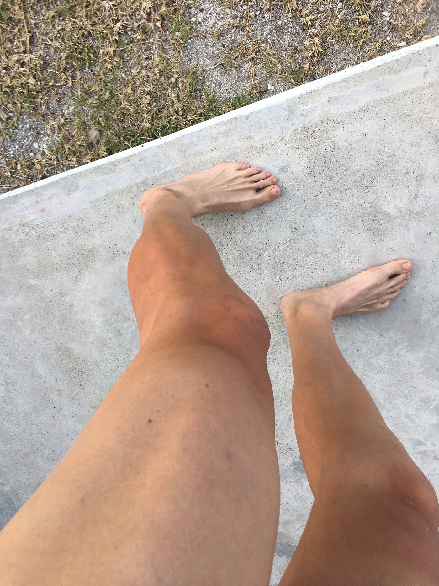 entry 11. So why do cyclists shave legs? | by The Lone Thriver | Medium