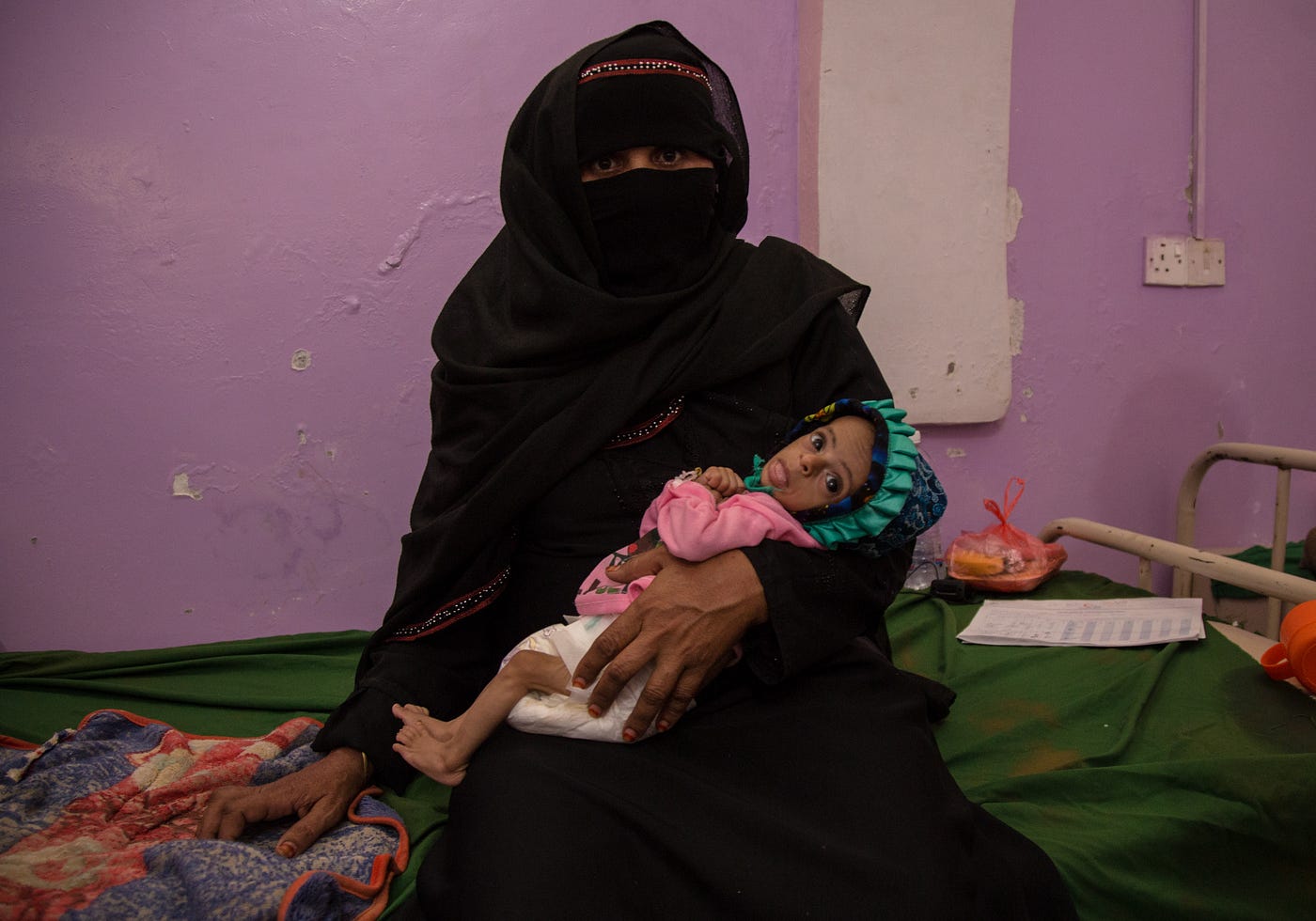 Tidlig inngripen er kritisk for å forhindre at feilernæring forårsaker død eller irreversibel og vedvarende skade. Bilde: WFP/Annabel Symington.
