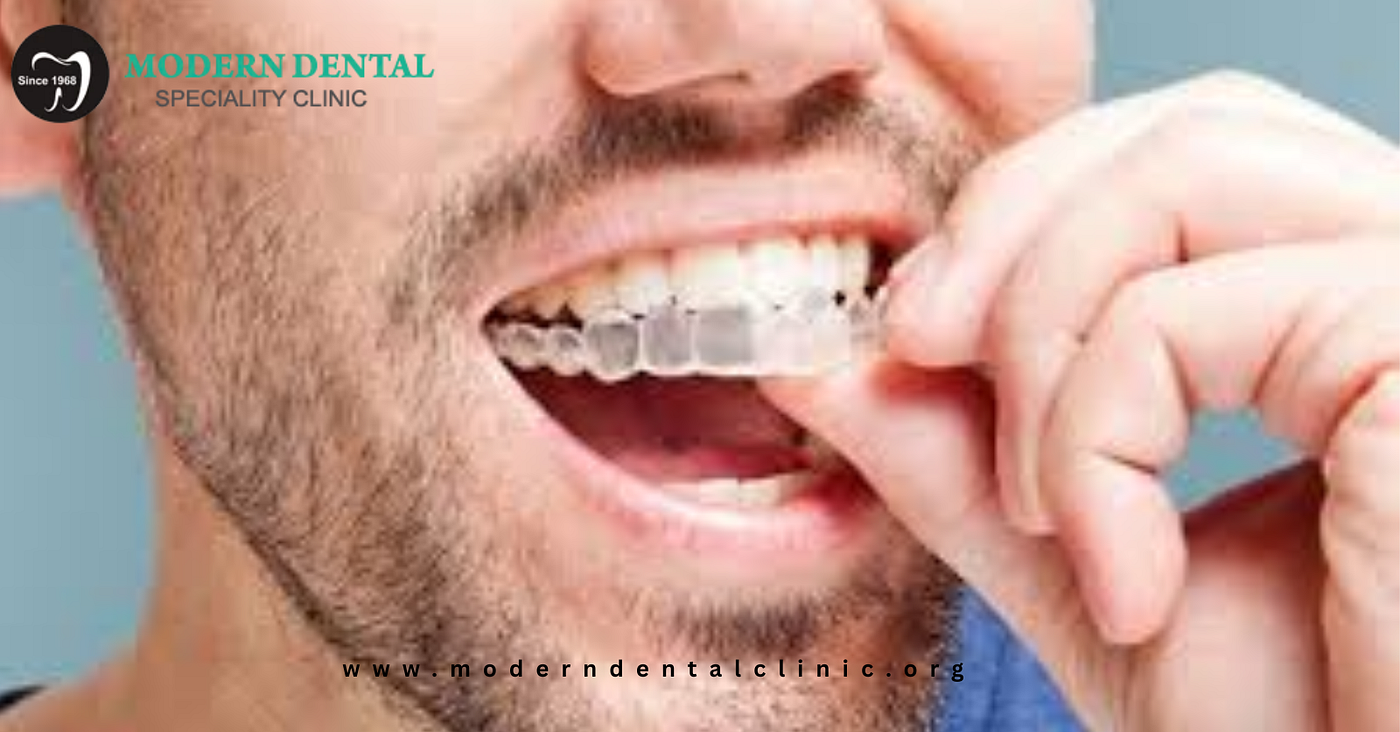 Best Aligner Treatment in Manjeri for Overbite Correction: What Patients Should Know