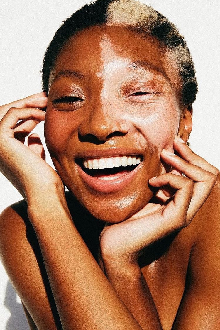 How To Embrace Your Natural Beauty