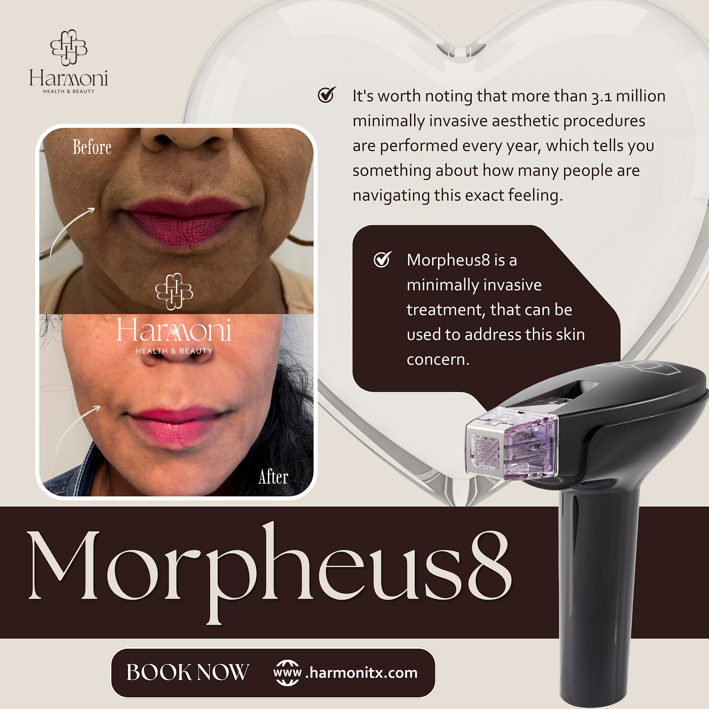 Why Choose Morpheus8 in Frisco TX for Skin Renewal