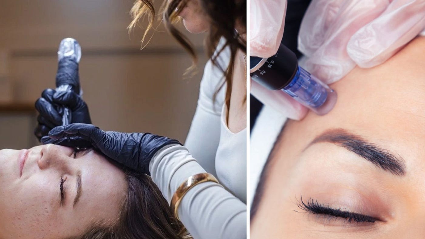 Is Microchanneling the Same as Microneedling?