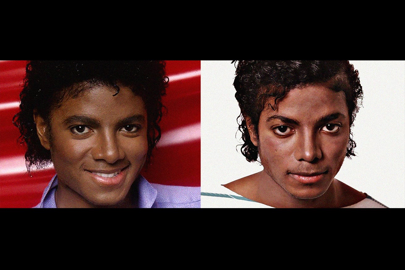 michael jackson before and after nose job