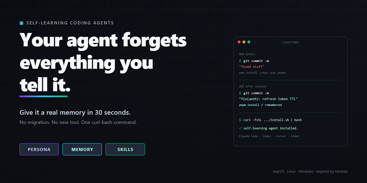 Your Coding Agent Forgets Everything You Tell It. Here’s the 30-Second Fix.