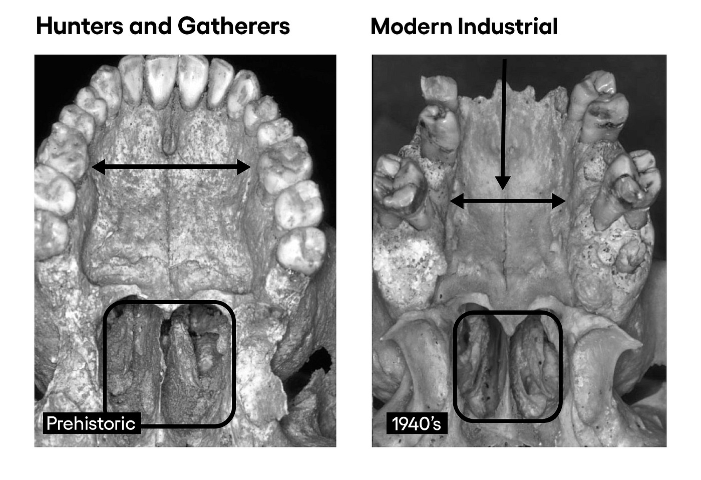 Our Skulls Are Out-Evolving Us. A motley crew of scientists argue