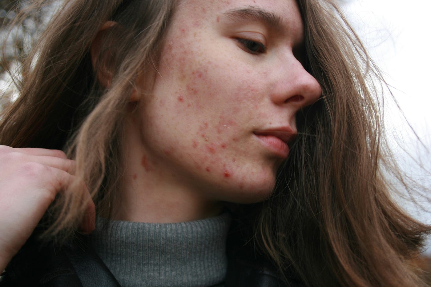 There marks used to make me avoid photos