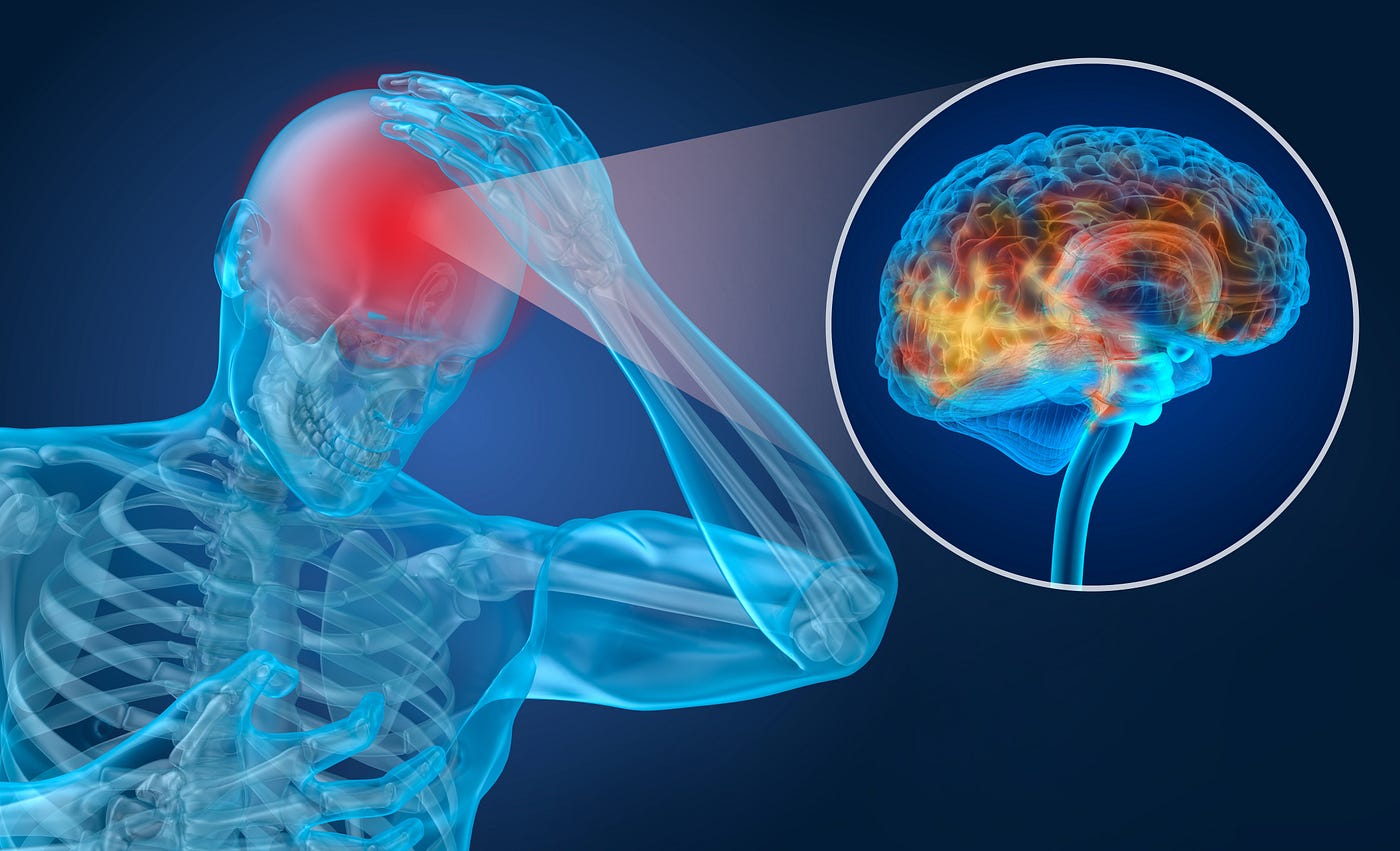 Concussion and Upper Cervical Care