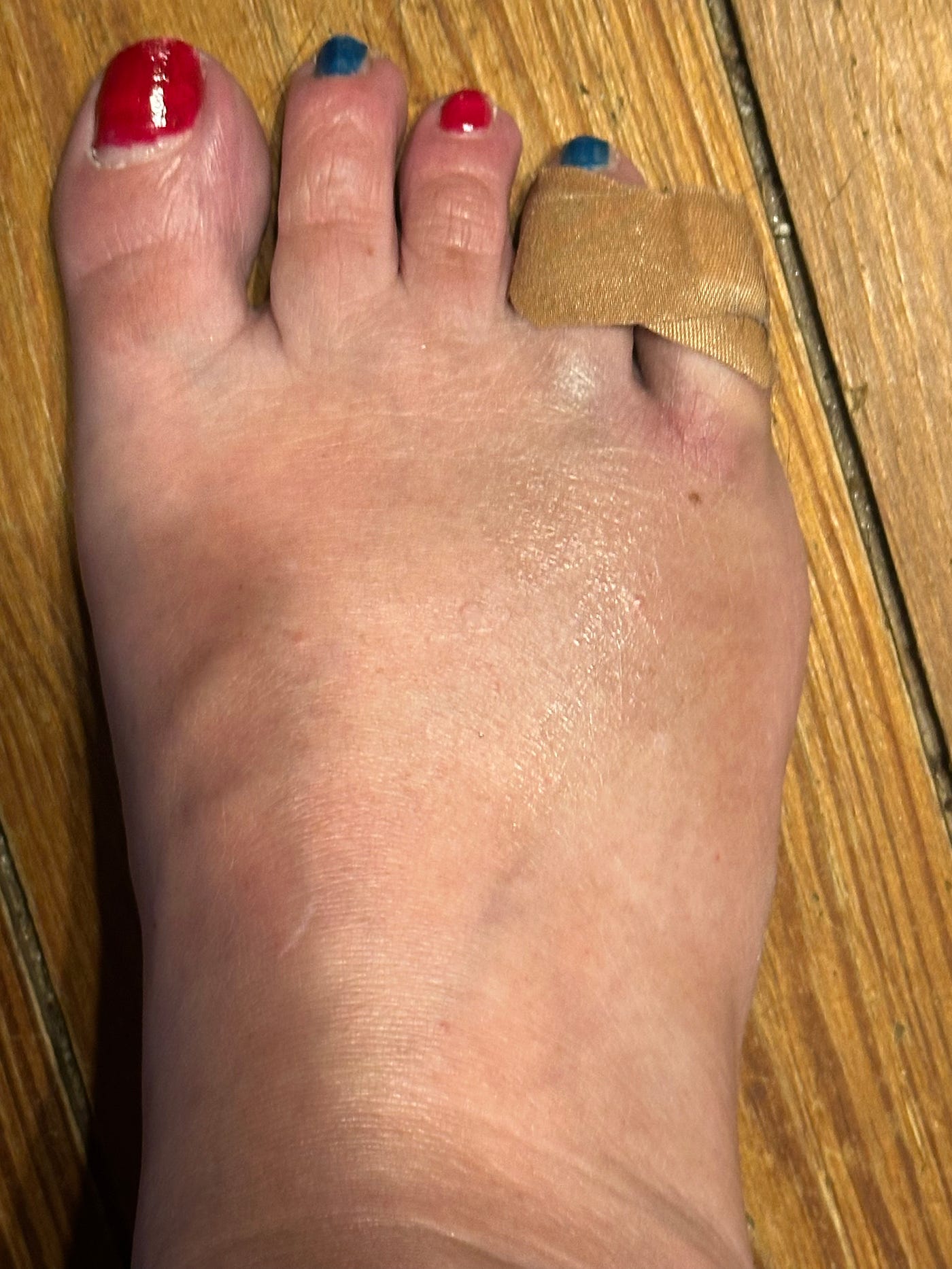 I’ve Got More Brains in My Little Toe