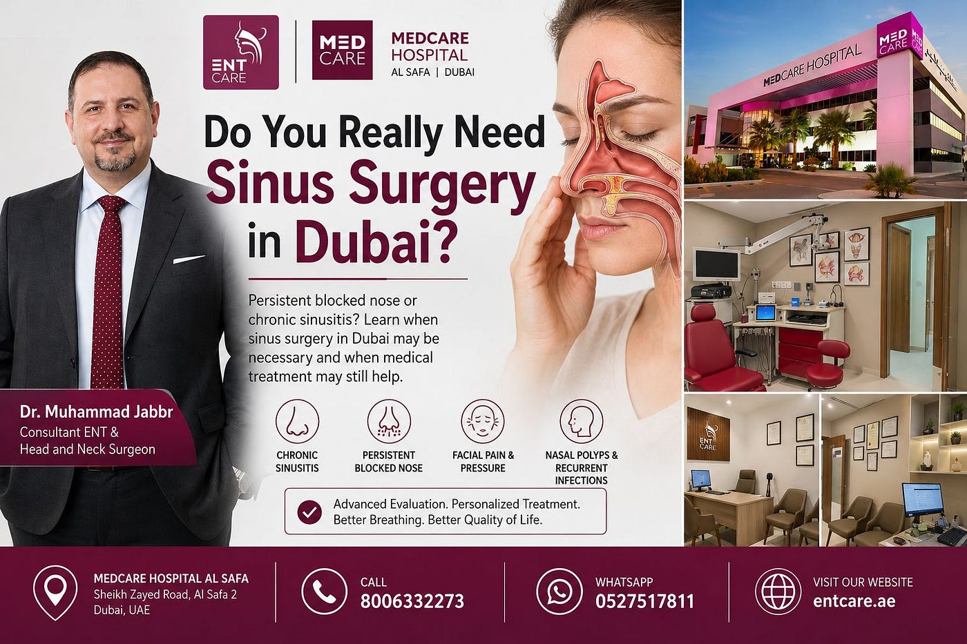 Do You Really Need Sinus Surgery in Dubai?