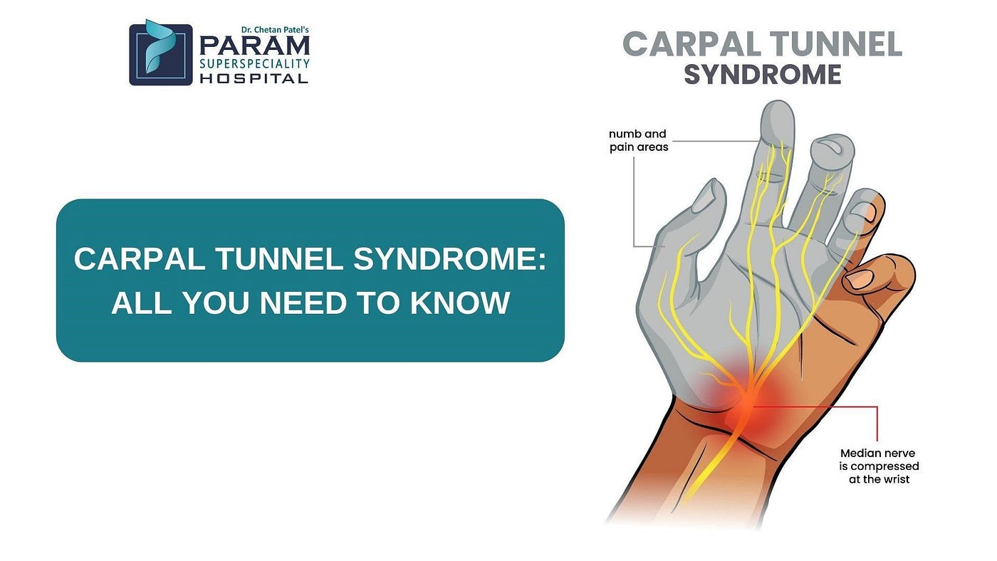 Carpal Tunnel Syndrome — All You Need To Know, by  paramsuperspecialityhospital