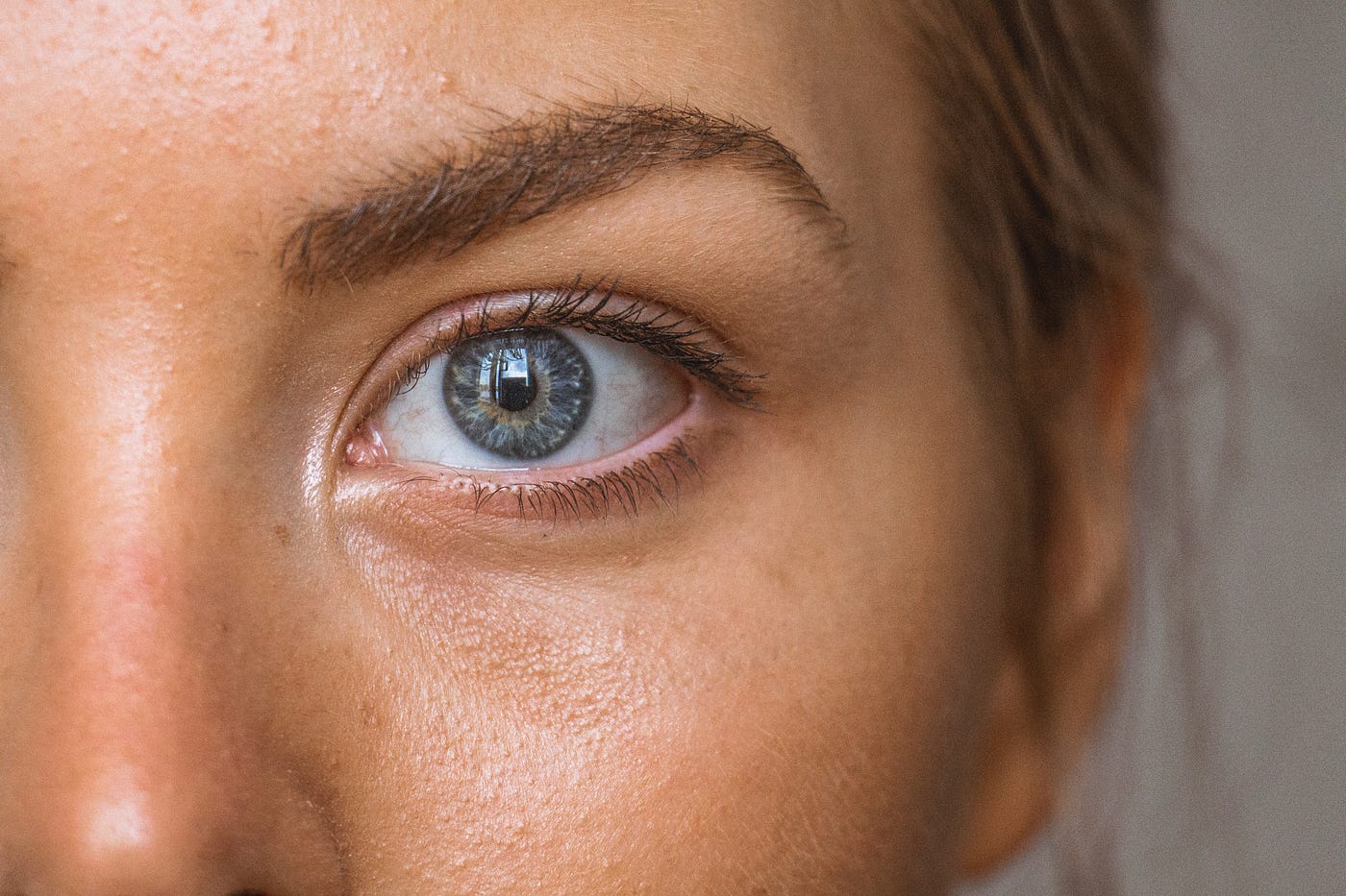 What Type of Eye Bags Do You Have?, by Julia Brown