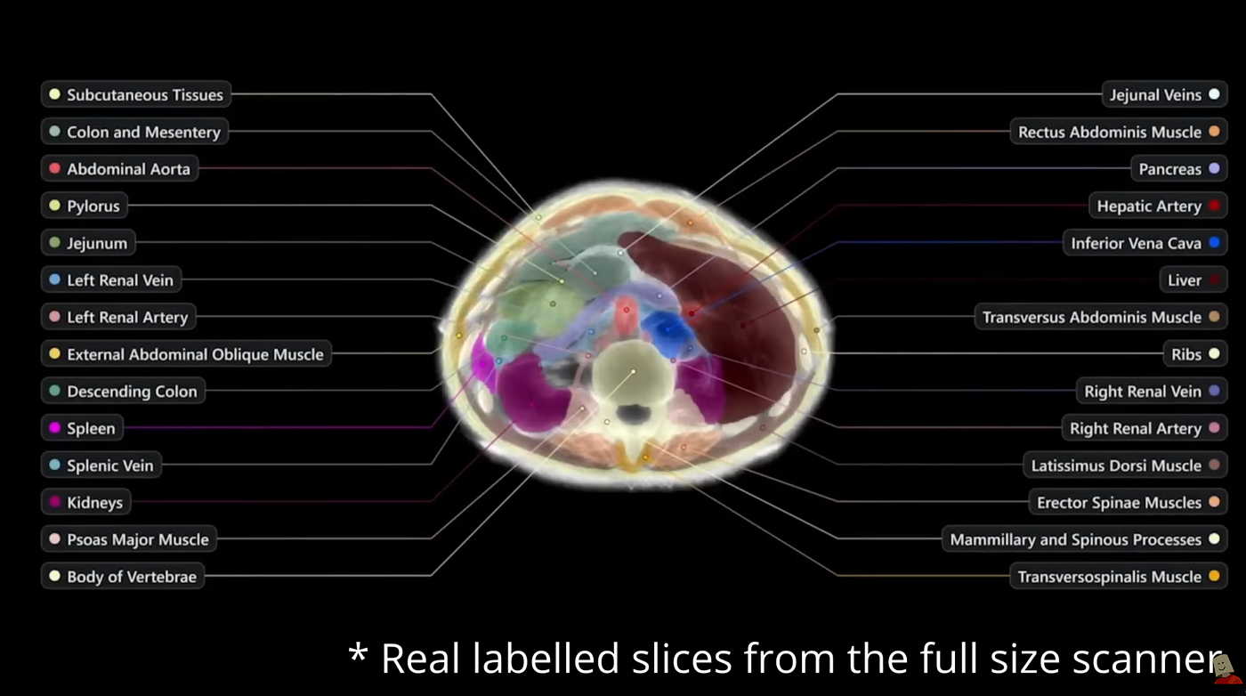 a screen image of a colored coded scan from the video