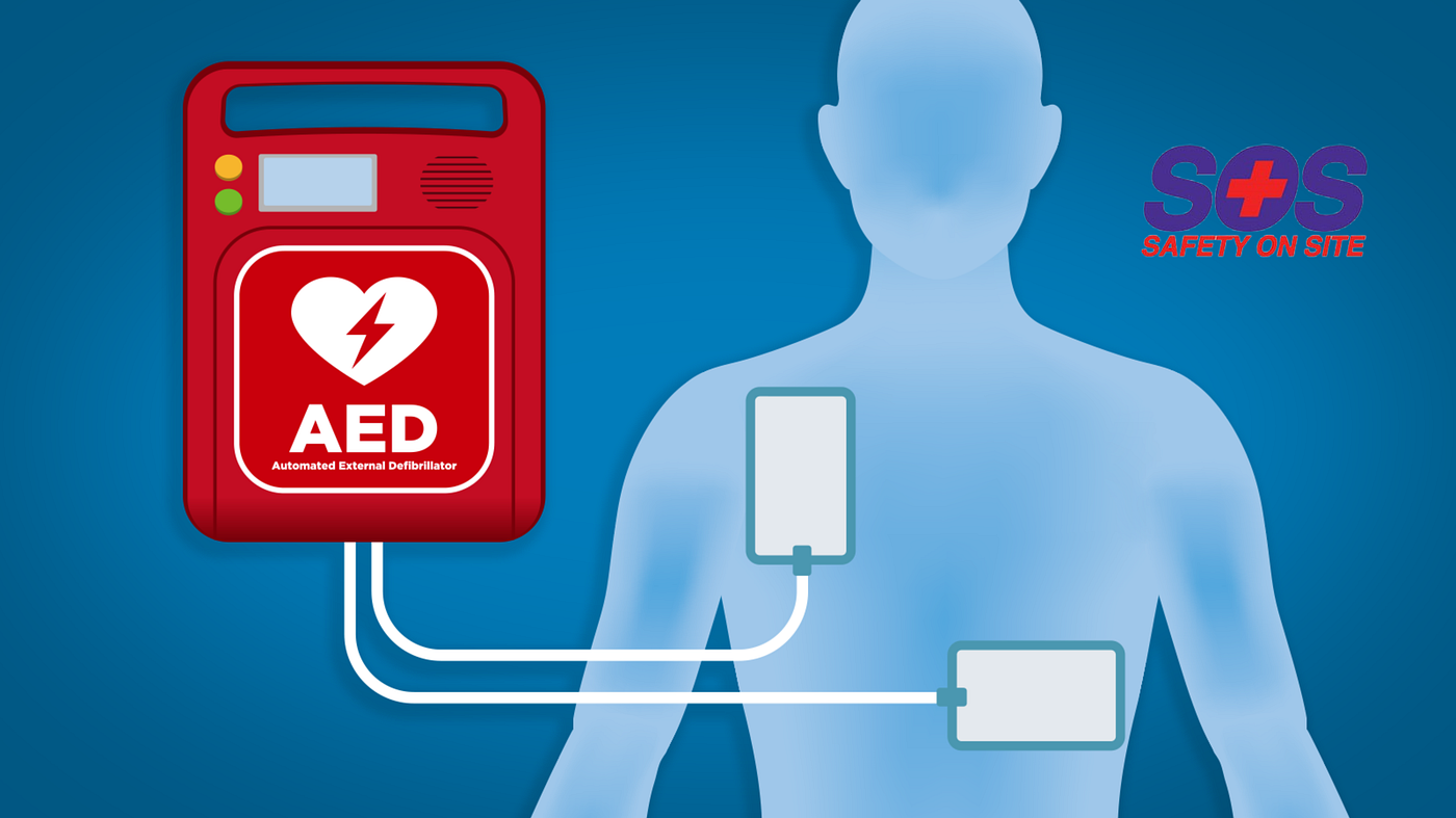 Common FAQs and Facts about AED | SOS First Aid