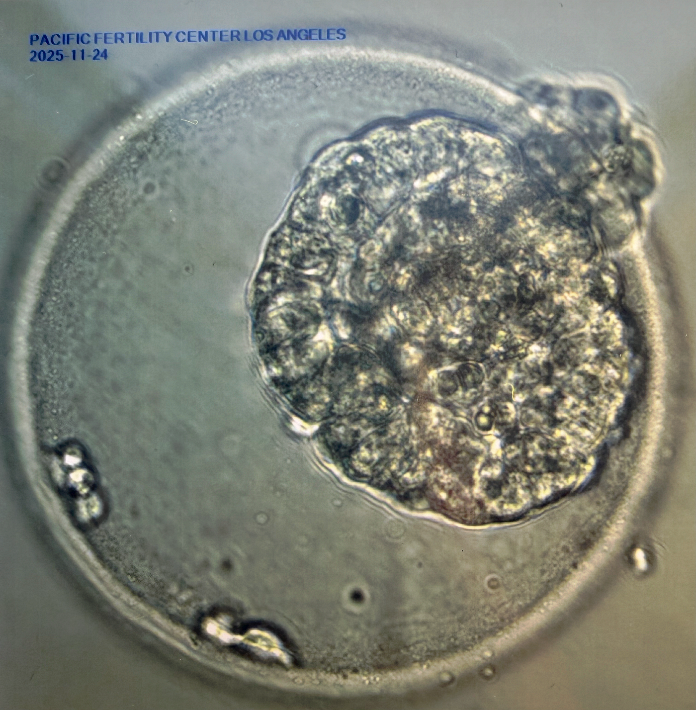 Diary of an International Embryo Transfer