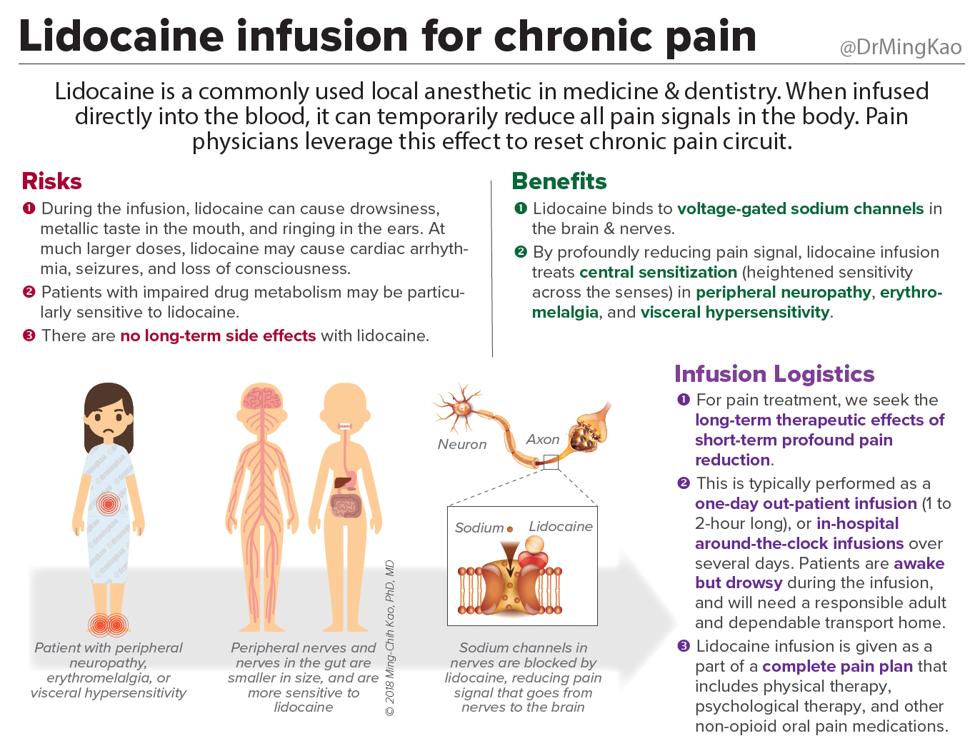 Lidocaine infusion therapy for chronic pain :: The Pain Team