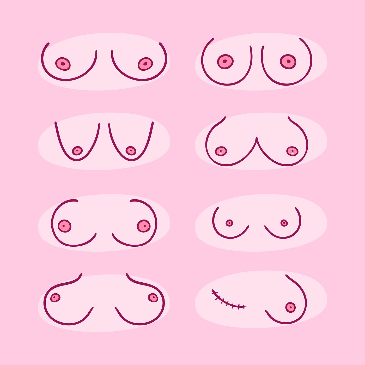 Different Types of Breast Shapes & Bra Suggestions