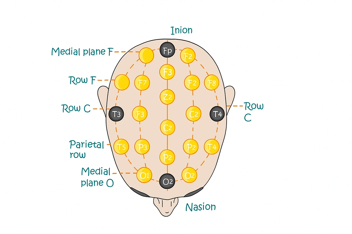 Bridging Minds and Machines. The Evolution and Impact of EEG and