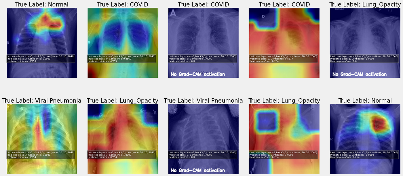 Detecting COVID-19 from Chest X-rays: A Deep Learning Approach using ResNet50V2 with Grad CAM