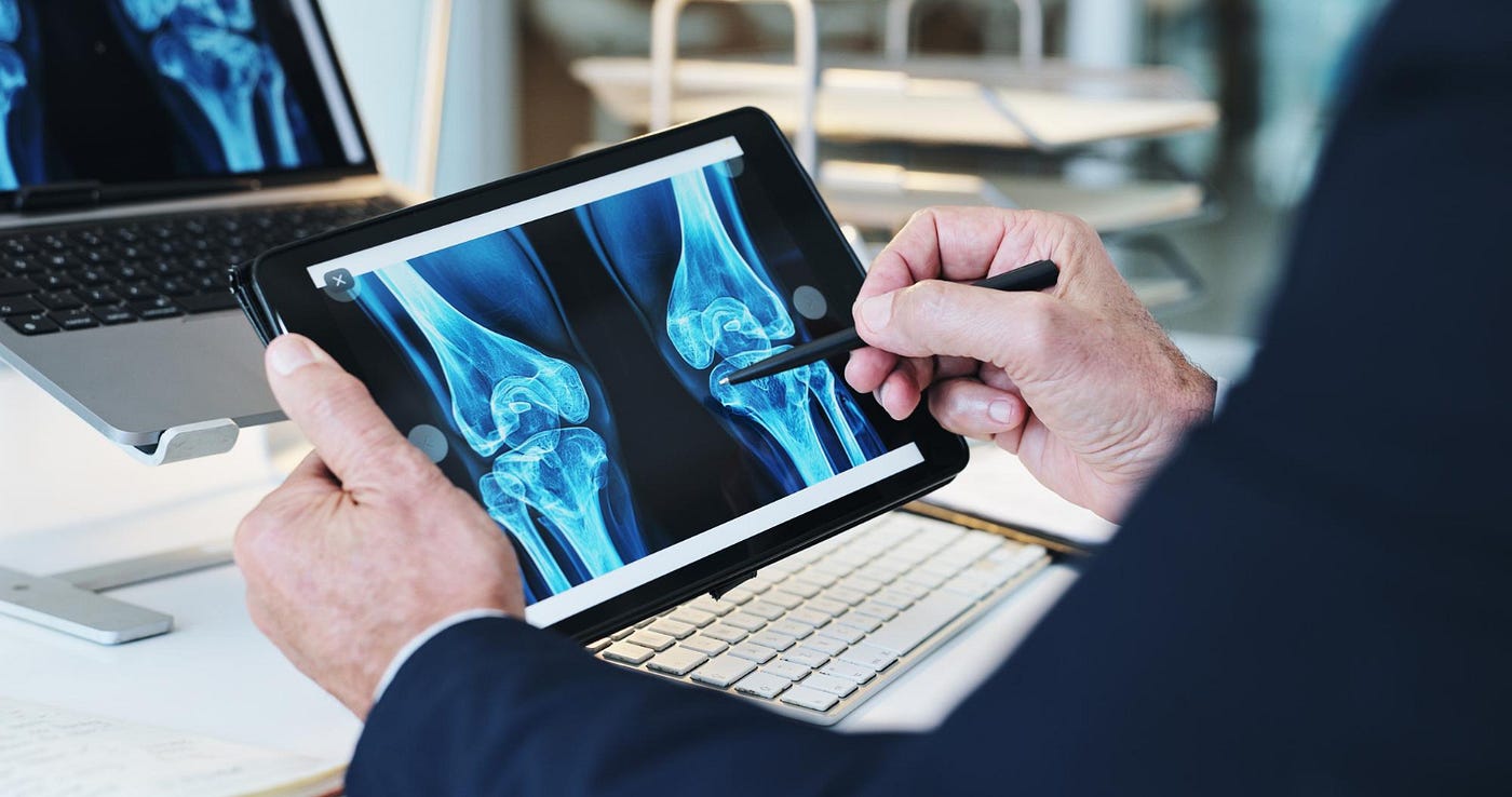 How Corporate Wellness Bone Screening Improves Employee Health Outcomes