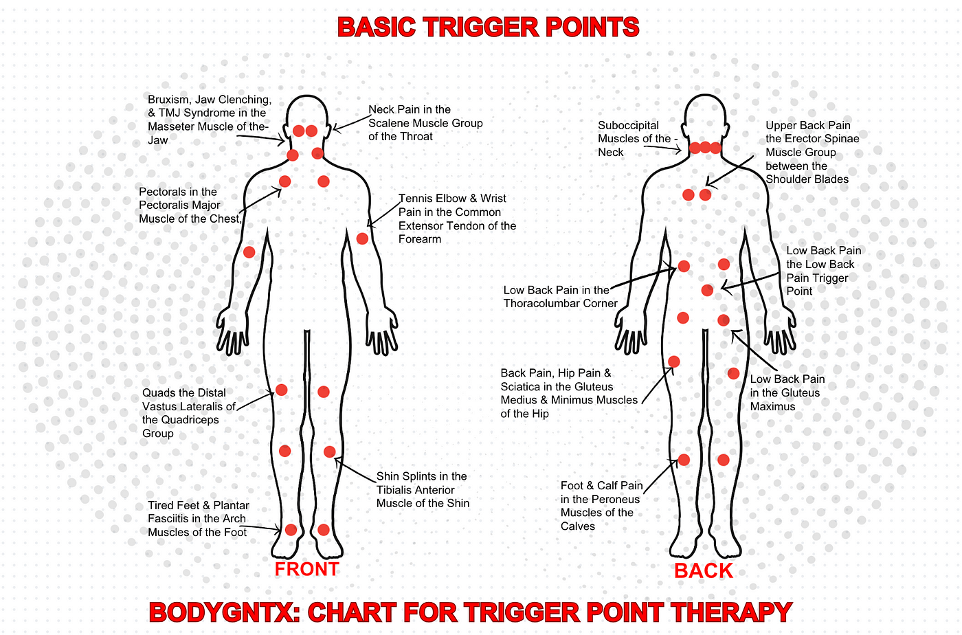 Lower Back Trigger Points - A Key To Lower Back Pain Relief