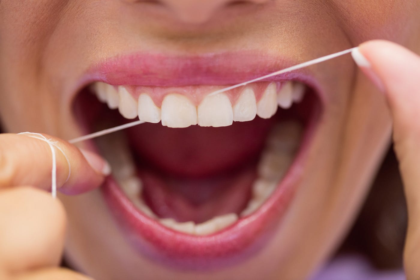 Why You Absolutely Need to Floss (Despite the Rumors)