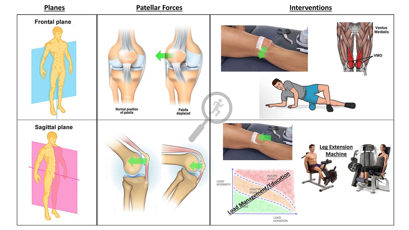 Rehab to Robust - Powering Past Patellofemoral Pain – Part 8 – Why Patellar  'Maltracking' is BS Patellar maltracking, or increased lateral tracking  exists, but the reasons it's commonly attributed to are