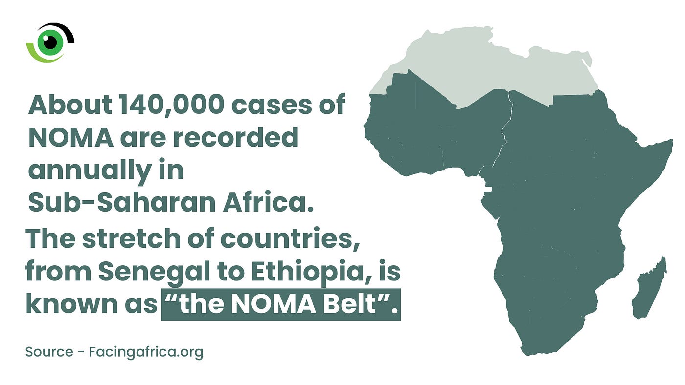 Noma: A neglected oral disease affecting Nigeria's children | by Nigeria  Health Watch | Medium