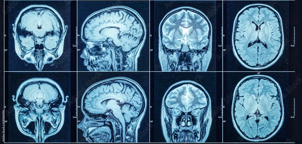 Platform Gatekeeping