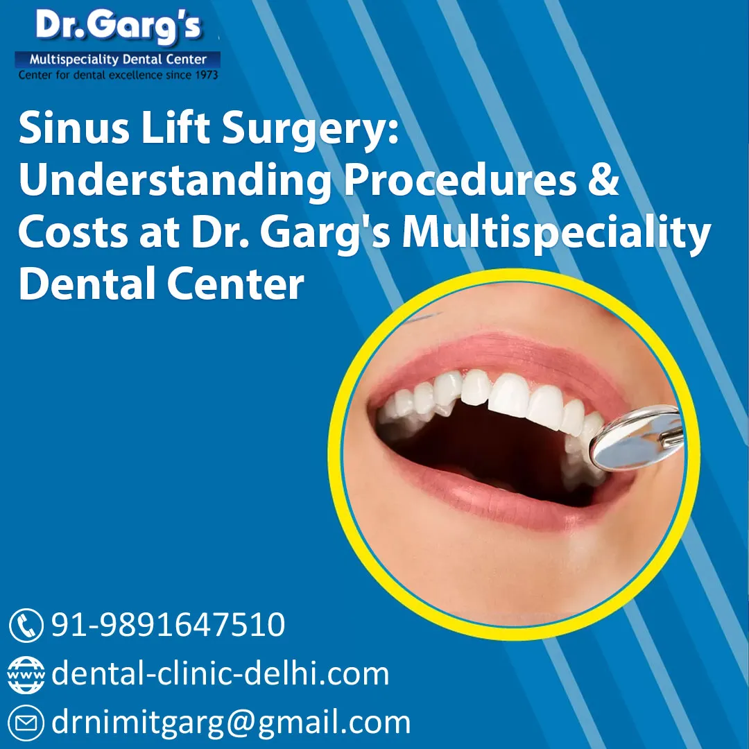 Sinus Lift Surgery: Understanding Procedures and Costs at Dr. Garg's Multispeciality Dental Center 1*xRL2bOvcXJkrpExik QX9g - Sinus Lift Surgery: Understanding Procedures and Costs at Dr. Garg's Multispeciality Dental Center