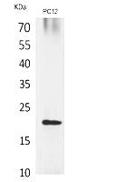 VEGF-B Polyclonal Antibody Review