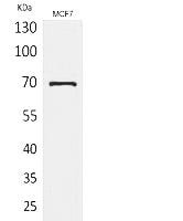 HSP70 Polyclonal Antibody Review