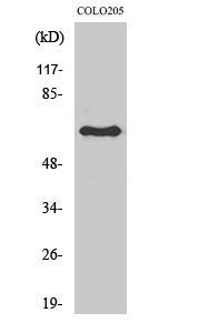 Lamin B1 Polyclonal Antibody Review