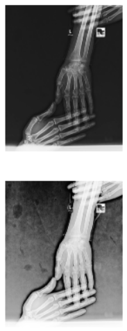 Original and Normalized Images