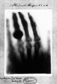 Google搜尋關鍵字:the first X-RAY image, Dec 1895 (圖片來源:wiki)
