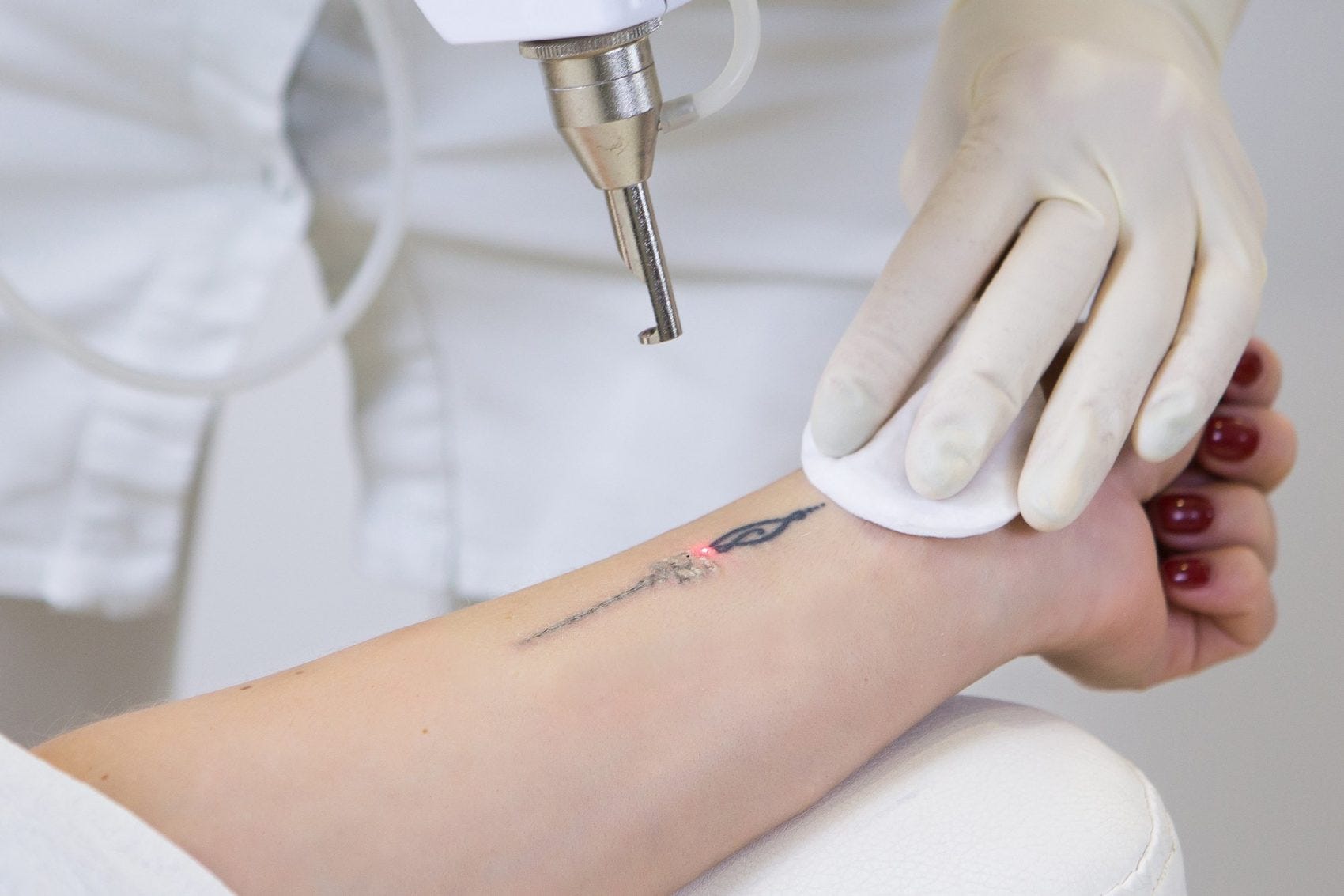 The Modern Approach to Tattoo Removal Service in 2024 | by Alphadnahealth  Com | Medium