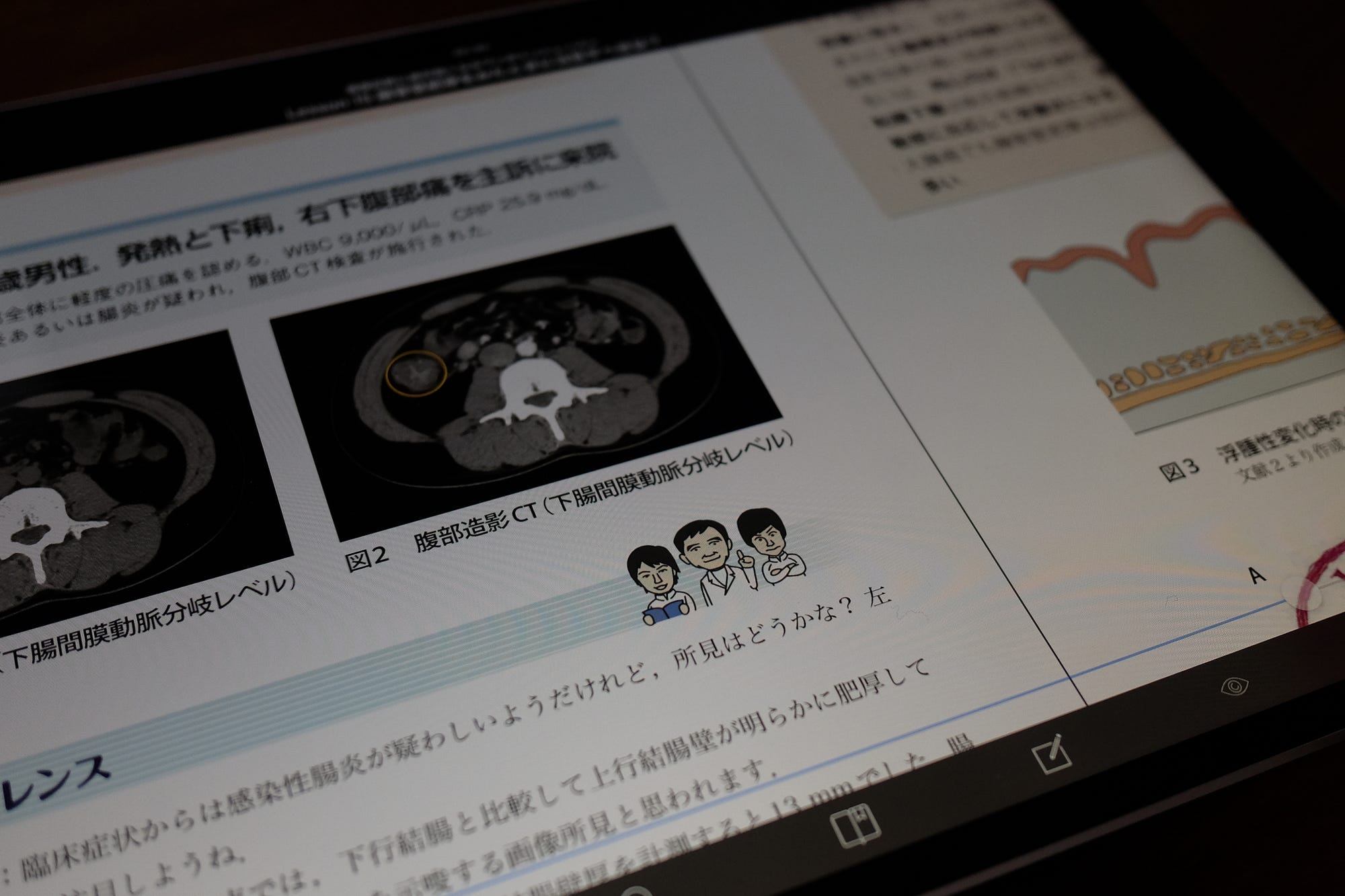放射線診断科を回る研修医にオススメの本とiPhone・iPadアプリ | by 