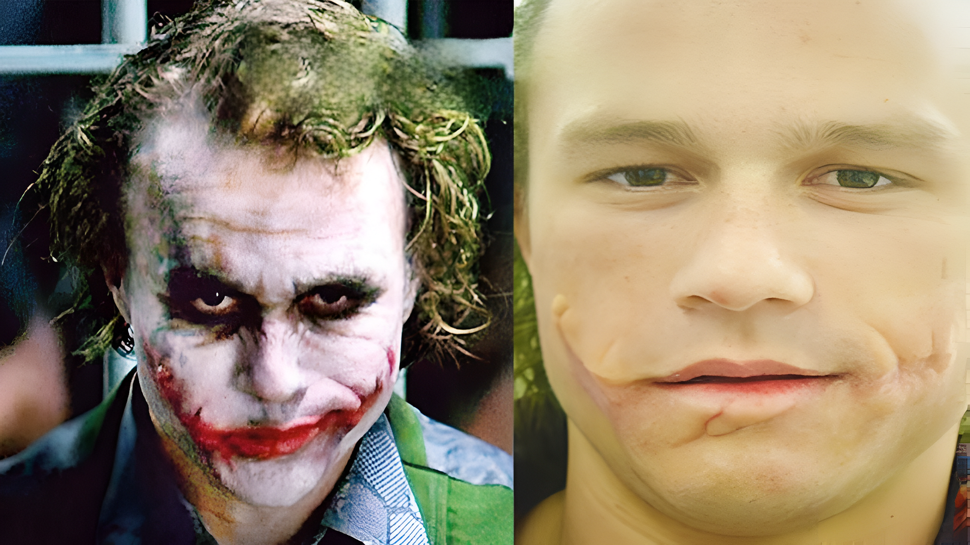 What Happened To Heath Ledger? Uncovering The Tragic Truth