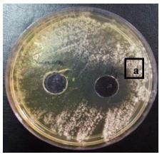 Antifungal and Hepatoprotective effects of Lactoferrin purified from camel milk against Candida…