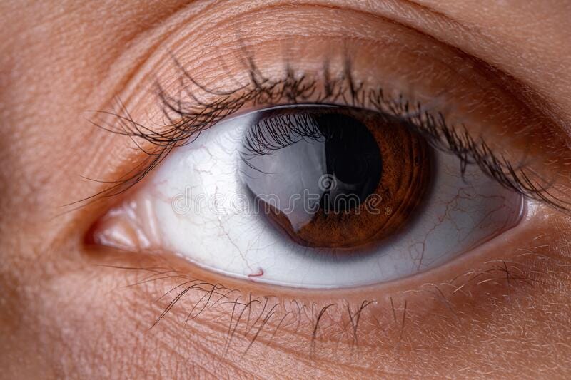 Vision Complex Medium